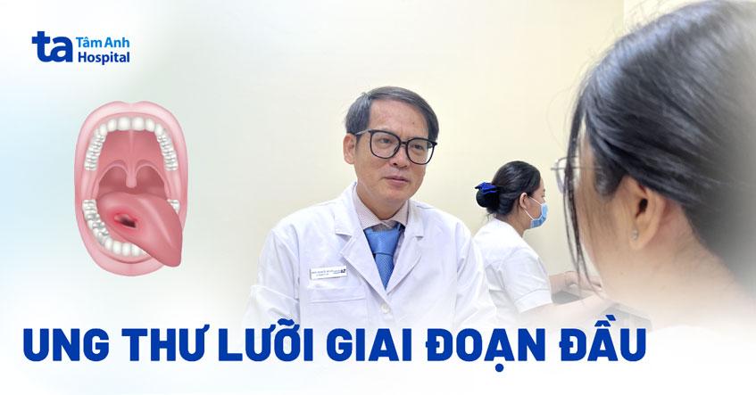 ung thư lưỡi giai đoạn đầu